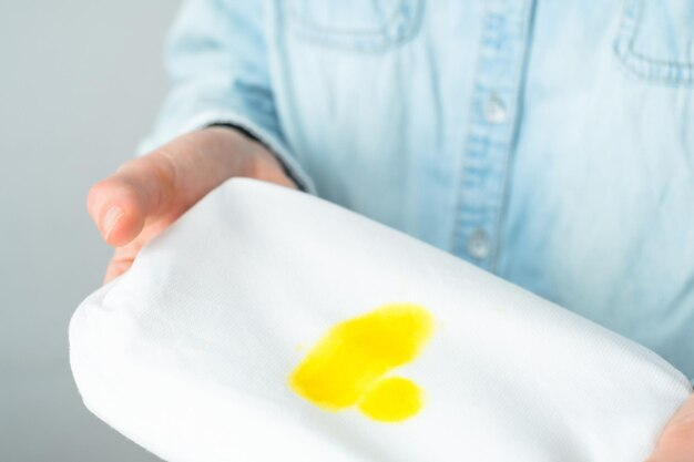  DIY solutions for removing yellow stains from white clothes
